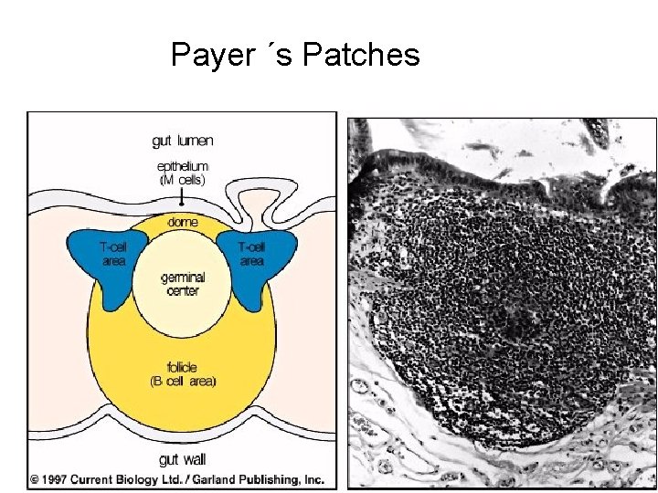 Payer ´s Patches 