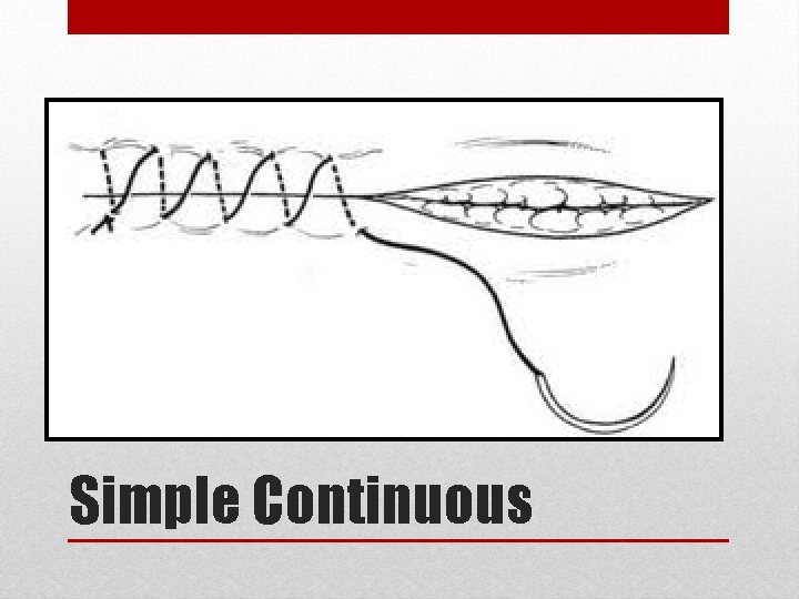 Simple Continuous 