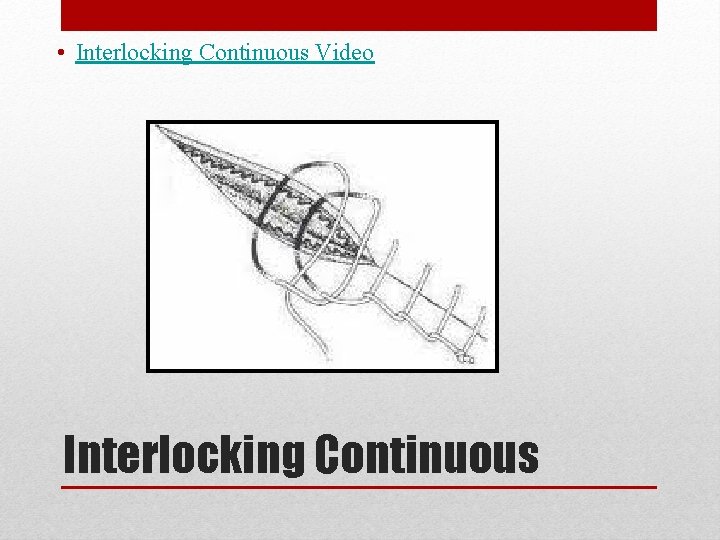  • Interlocking Continuous Video Interlocking Continuous 