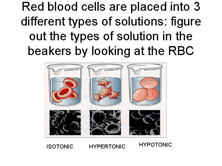 Red blood cells are placed into 3 different types of solutions: figure out the