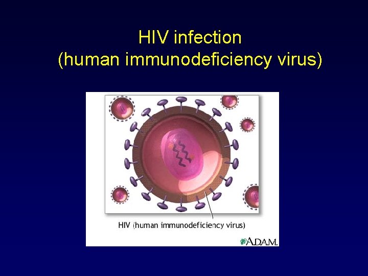 HIV infection (human immunodeficiency virus) 