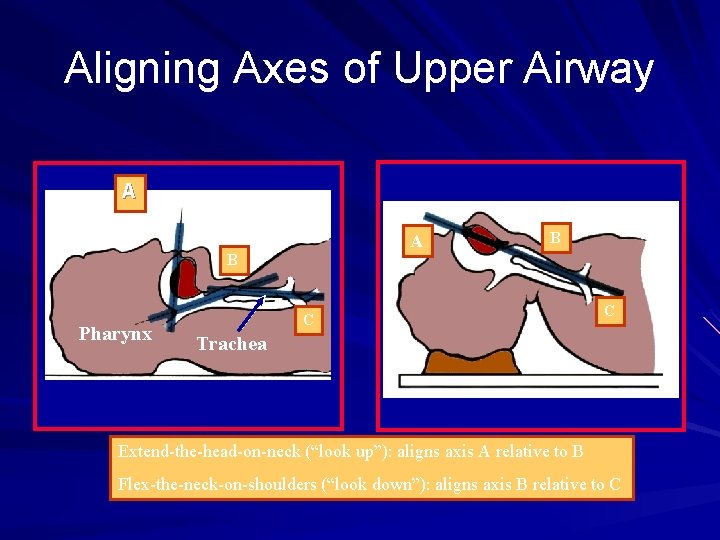 Aligning Axes of Upper Airway A Mouth A B B Pharynx C C Trachea