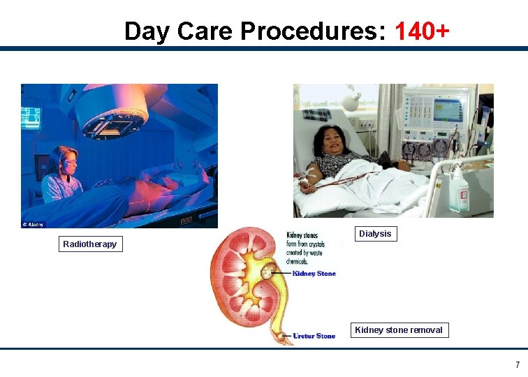 Day Care Procedures: 140+ Dialysis Radiotherapy Kidney stone removal 7 