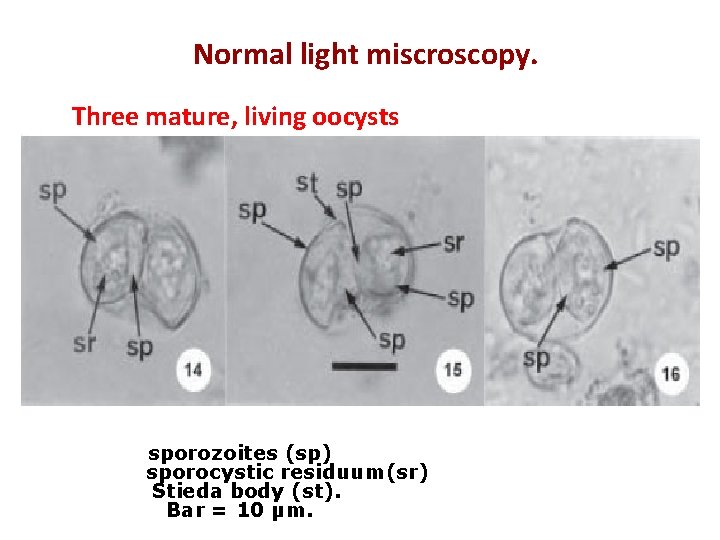 Normal light miscroscopy. Three mature, living oocysts sporozoites (sp) sporocystic residuum(sr) Stieda body (st).