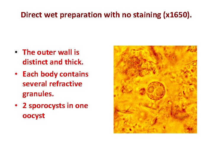 Direct wet preparation with no staining (x 1650). • The outer wall is distinct