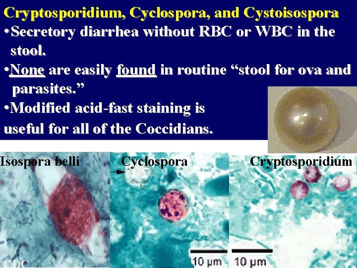 Cryptosporidium, Cyclospora, and Cystoisospora • Secretory diarrhea without RBC or WBC in the stool.