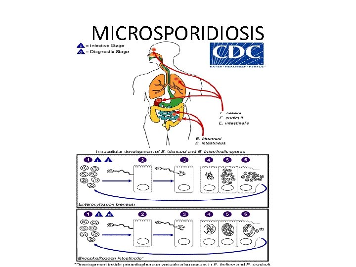 MICROSPORIDIOSIS 