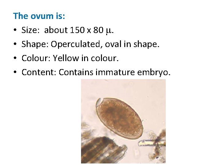 The ovum is: • Size: about 150 x 80 . • Shape: Operculated, oval