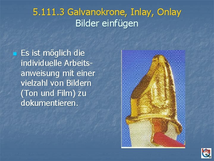 5. 111. 3 Galvanokrone, Inlay, Onlay Bilder einfügen n Es ist möglich die individuelle