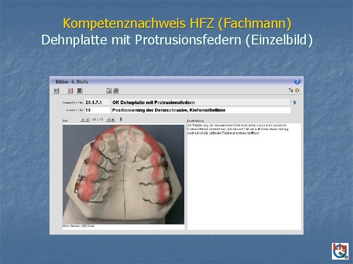 Kompetenznachweis HFZ (Fachmann) Dehnplatte mit Protrusionsfedern (Einzelbild) 