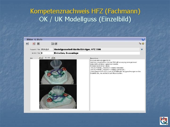 Kompetenznachweis HFZ (Fachmann) OK / UK Modellguss (Einzelbild) 