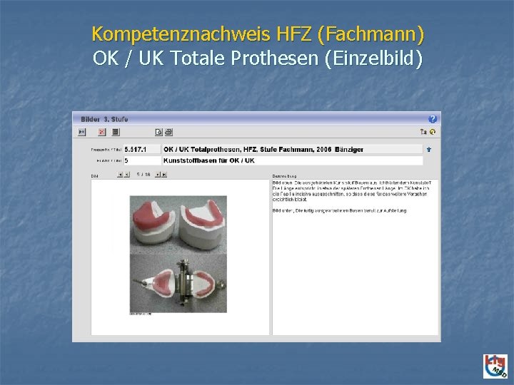 Kompetenznachweis HFZ (Fachmann) OK / UK Totale Prothesen (Einzelbild) 