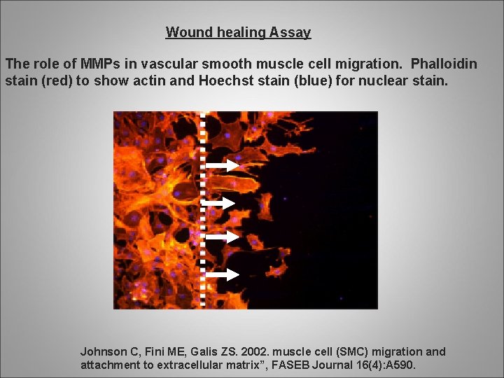 Wound healing Assay The role of MMPs in vascular smooth muscle cell migration. Phalloidin