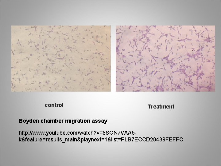 control Treatment Boyden chamber migration assay http: //www. youtube. com/watch? v=6 SON 7 VAA