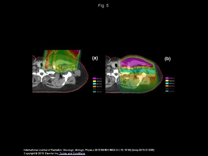 Fig. 5 International Journal of Radiation Oncology, Biology, Physics 2013 86484 -490 DOI: (10.