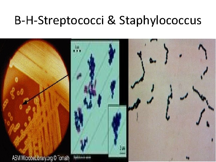 B-H-Streptococci & Staphylococcus 