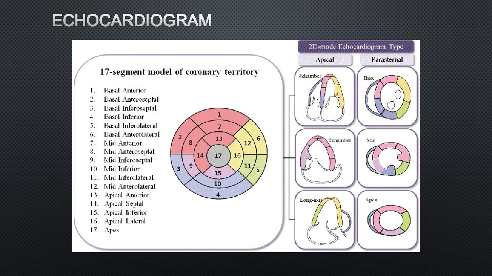 ECHOCARDIOGRAM 