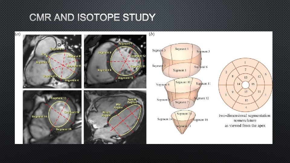 CMR AND ISOTOPE STUDY 