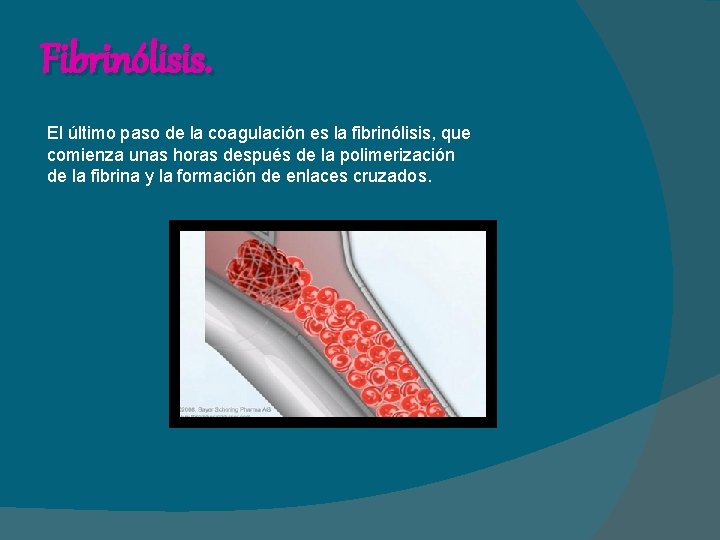 Fibrinólisis. El último paso de la coagulación es la fibrinólisis, que comienza unas horas