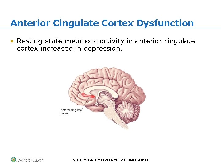 Anterior Cingulate Cortex Dysfunction • Resting-state metabolic activity in anterior cingulate cortex increased in