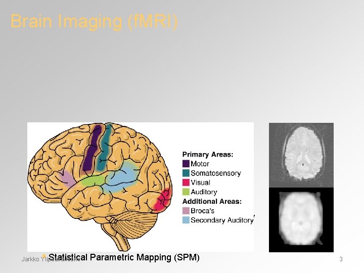 Brain Imaging (f. MRI) Hemodynamic Responses § Blood Oxygenation Dependent Signal § Complex and