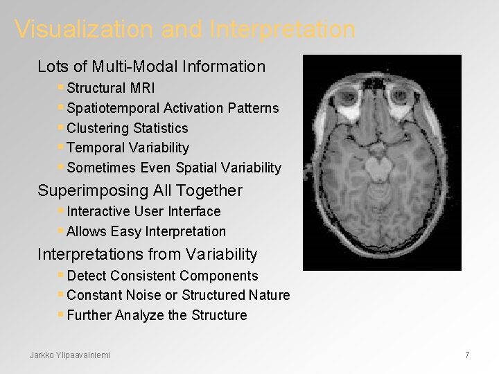 Visualization and Interpretation Lots of Multi-Modal Information § Structural MRI § Spatiotemporal Activation Patterns
