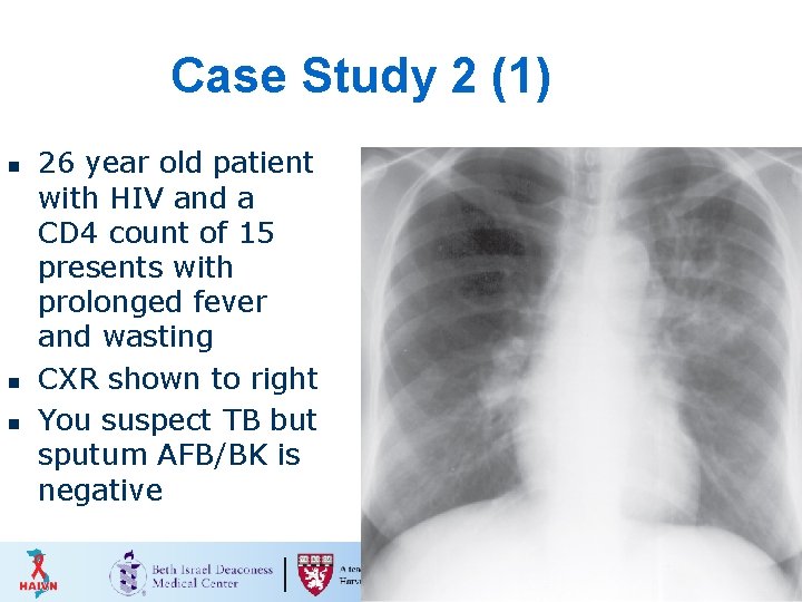 Case Study 2 (1) n n n 26 year old patient with HIV and