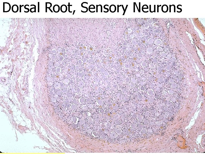 Dorsal Root, Sensory Neurons 