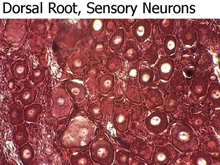 Dorsal Root, Sensory Neurons 