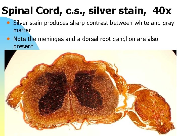 Spinal Cord, c. s. , silver stain, 40 x • Silver stain produces sharp