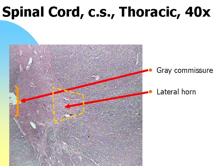 Spinal Cord, c. s. , Thoracic, 40 x • Gray commissure • Lateral horn