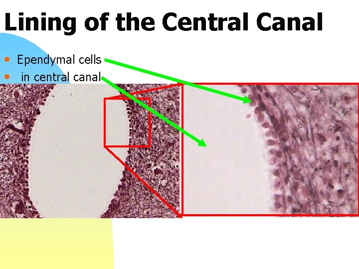 Lining of the Central Canal • Ependymal cells • in central canal 