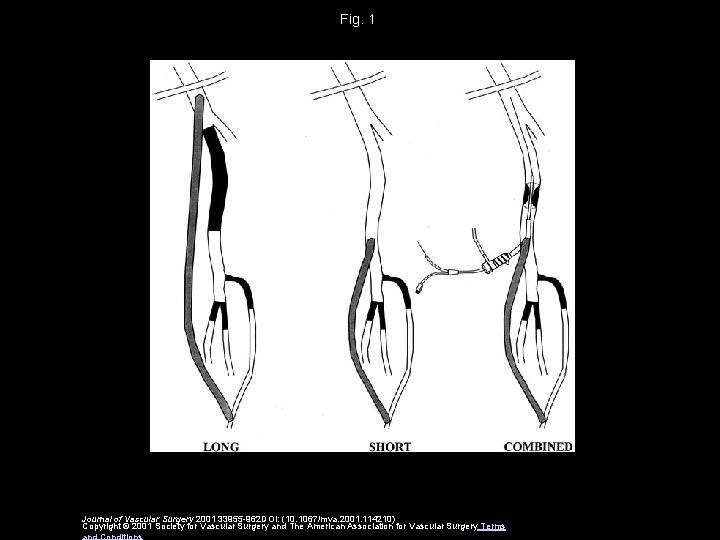Fig. 1 Journal of Vascular Surgery 2001 33955 -962 DOI: (10. 1067/mva. 2001. 114210)