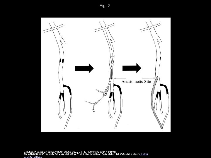 Fig. 2 Journal of Vascular Surgery 2001 33955 -962 DOI: (10. 1067/mva. 2001. 114210)