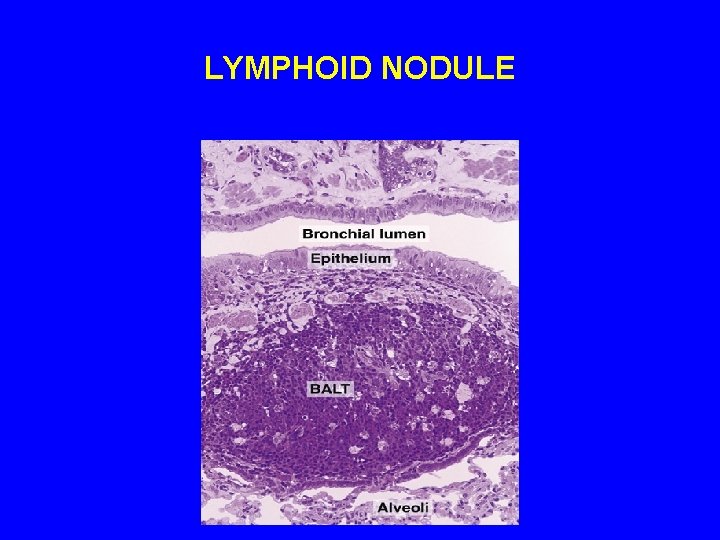 LYMPHOID NODULE 