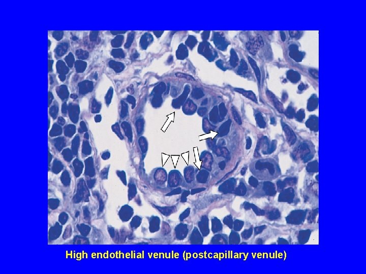 High endothelial venule (postcapillary venule) 
