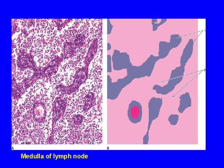 Medulla of lymph node 