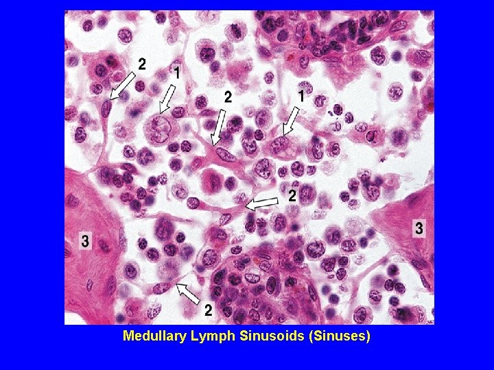 Medullary Lymph Sinusoids (Sinuses) 