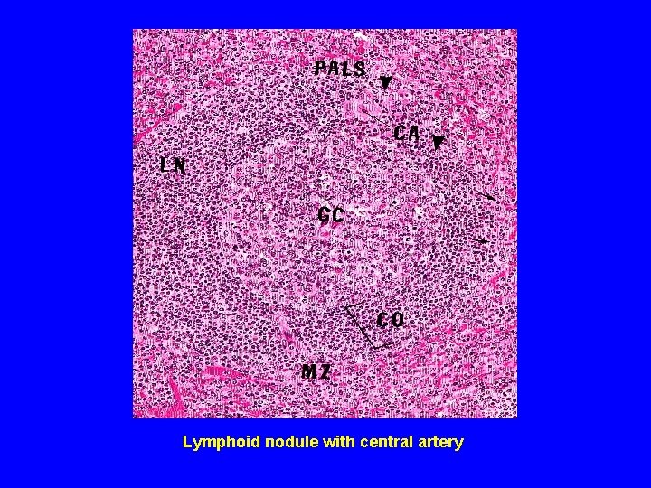Lymphoid nodule with central artery 