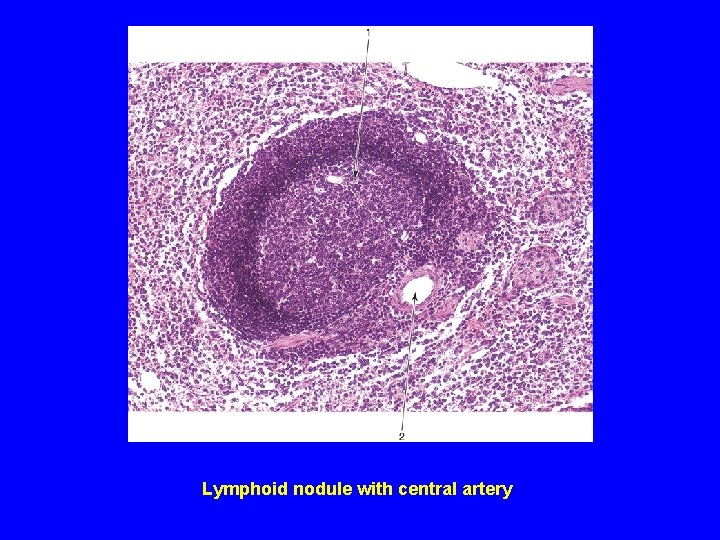 Lymphoid nodule with central artery 