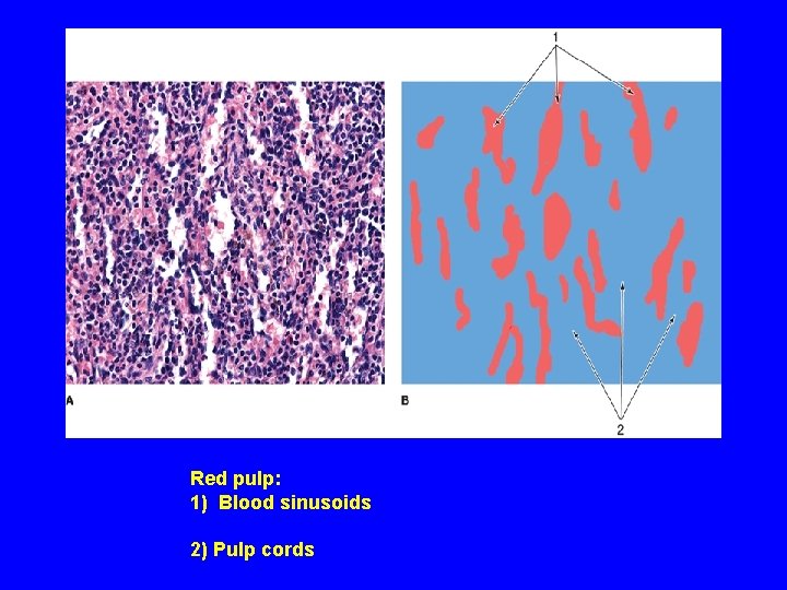 Red pulp: 1) Blood sinusoids 2) Pulp cords 