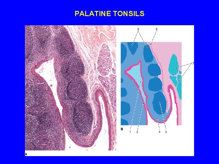 PALATINE TONSILS 