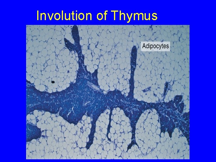 Involution of Thymus 