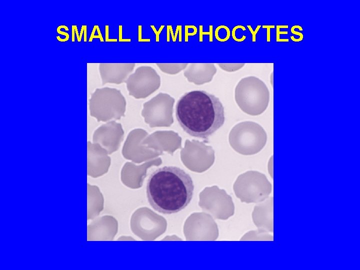 SMALL LYMPHOCYTES 
