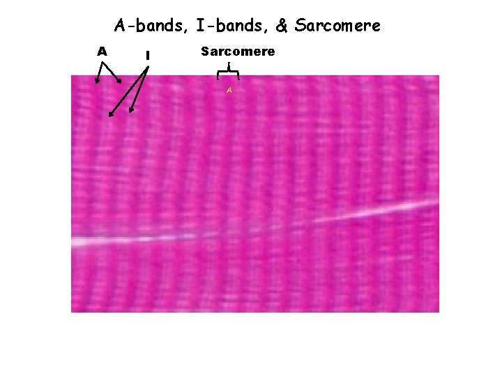 A-bands, I-bands, & Sarcomere A I Sarcomere A 