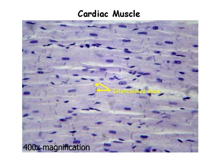 Cardiac Muscle Intercalated discs 