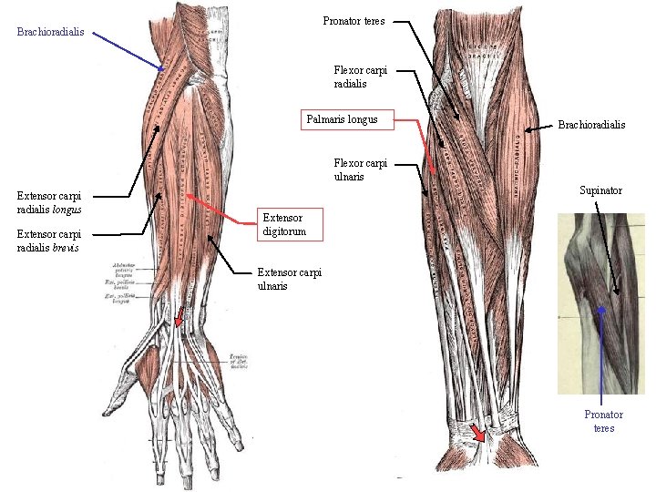 Pronator teres Brachioradialis Flexor carpi radialis Palmaris longus Brachioradialis Flexor carpi ulnaris Extensor carpi