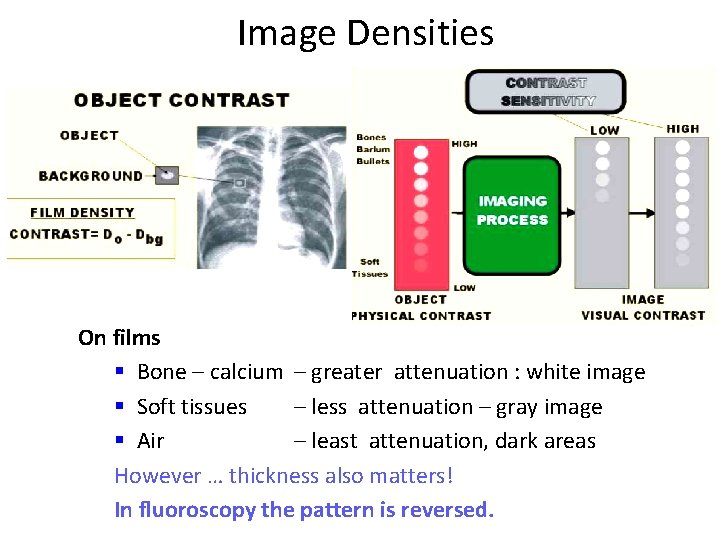 Image Densities On films § Bone – calcium – greater attenuation : white image