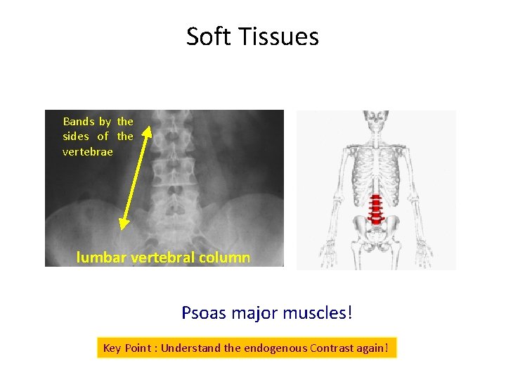 Soft Tissues Bands by the sides of the vertebrae lumbar vertebral column Psoas major