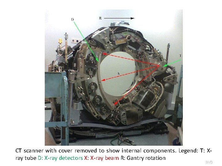 CT scanner with cover removed to show internal components. Legend: T: Xray tube D: